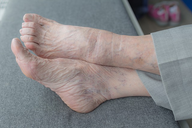 Podiatry can effectively manage ageing people's feet issues , Epping podiatry